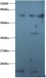RPS16 / Ribosomal Protein S16 Antibody - Western blot of RPS16 protein antibody at 2 ug/ml. Lane 1:293T whole cell lysate. Lane 2: EC109 whole cell lysate. Secondary: Goat polyclonal to Rabbit IgG at 1:15000 dilution. Predicted band size: 17 kDa. Observed band size: 17 kDa Additional bands at: 80 kDa. We are unsure as to the identity of this extra band. This image was taken for the unconjugated form of this product. Other forms have not been tested.
