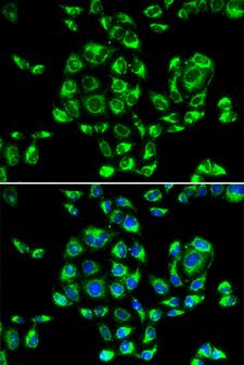 RPS16 / Ribosomal Protein S16 Antibody - Immunofluorescence analysis of U20S cells.