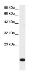 RPS16 / Ribosomal Protein S16 Antibody - Jurkat Cell Lysate.  This image was taken for the unconjugated form of this product. Other forms have not been tested.