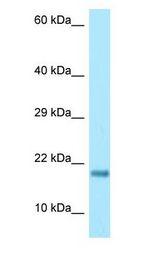 RPS17 / Ribosomal Protein S17 Antibody - RPS17 / S17 antibody Western Blot of HeLa.  This image was taken for the unconjugated form of this product. Other forms have not been tested.