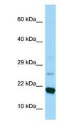 RPS17 / Ribosomal Protein S17 Antibody - RPS17 / S17 antibody Western Blot of Fetal Kidney.  This image was taken for the unconjugated form of this product. Other forms have not been tested.