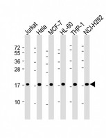 RPS17 / Ribosomal Protein S17 Antibody - All lanes: Anti-RPS17 Antibody (Center) at 1:2000 dilution Lane 1: Jurkat whole cell lysate Lane 2: Hela whole cell lysate Lane 3: MCF-7 whole cell lysate Lane 4: HL-60 whole cell lysate Lane 5: THP-1 whole cell lysate Lane 6: NCI-H292 whole cell lysate Lysates/proteins at 20 µg per lane. Secondary Goat Anti-Rabbit IgG, (H+L), Peroxidase conjugated at 1/10000 dilution. Predicted band size: 16 kDa Blocking/Dilution buffer: 5% NFDM/TBST.