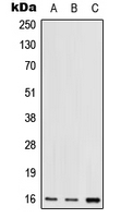 RPS17 / Ribosomal Protein S17 Antibody - Western blot analysis of RPS17 expression in HEK293T (A); mouse lung (B); rat lung (C) whole cell lysates.