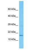 RPS18 / Ribosomal Protein S18 Antibody - RPS18 /S18 antibody Western Blot of HepG2. Antibody dilution: 1 ug/ml.  This image was taken for the unconjugated form of this product. Other forms have not been tested.