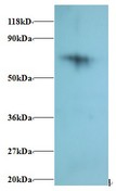 RPS18 / Ribosomal Protein S18 Antibody - Western blot of 40S ribosomal protein S18 Antibody at 2 ug/ml + 293T whole cell lysate at 20 ug. Secondary: Goat polyclonal to Rabbit IgG at 1:15000 dilution. Predicted band size: 16 kDa. Observed band size: 75 kDa.  This image was taken for the unconjugated form of this product. Other forms have not been tested.