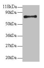 RPS18 / Ribosomal Protein S18 Antibody - Western blot 40S ribosomal protein S18 antibody at 2µg/ml + 293T whole cell lysate Secondary Goat polyclonal to rabbit IgG at 1/15000 dilution Predicted band size: 16 kDa Observed band size: 75 kDa