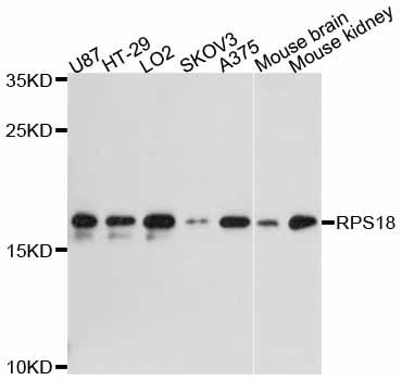 RPS18 / Ribosomal Protein S18 Antibody - Western blot analysis of extracts of various cell lines, using RPS18 antibody at 1:3000 dilution. The secondary antibody used was an HRP Goat Anti-Rabbit IgG (H+L) at 1:10000 dilution. Lysates were loaded 25ug per lane and 3% nonfat dry milk in TBST was used for blocking. An ECL Kit was used for detection and the exposure time was 90s.