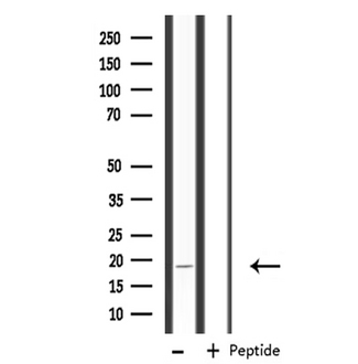 RPS18 / Ribosomal Protein S18 Antibody - Western blot analysis of extracts of K562 cells using RPS18 antibody.