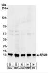 RPS19 / Ribosomal Protein S19 Antibody - Detection of Human and Mouse RPS19 by Western Blot. Samples: Whole cell lysate (50 ug) from HeLa, 293T, Jurkat, mouse TCMK-1, and mouse NIH3T3 cells. Antibodies: Affinity purified rabbit anti-RPS19 antibody used for WB at 0.1 ug/ml. Detection: Chemiluminescence with an exposure time of 3 minutes.