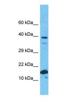 RPS19 / Ribosomal Protein S19 Antibody - Western blot of RS19 Antibody with human Fetal Kidney lysate.  This image was taken for the unconjugated form of this product. Other forms have not been tested.