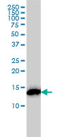 RPS19 / Ribosomal Protein S19 Antibody - RPS19 monoclonal antibody (M01), clone 3C6 Western Blot analysis of RPS19 expression in K-562.
