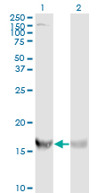 RPS19 / Ribosomal Protein S19 Antibody - Western Blot analysis of RPS19 expression in transfected 293T cell line by RPS19 monoclonal antibody (M01), clone 3C6.Lane 1: RPS19 transfected lysate(16.1 KDa).Lane 2: Non-transfected lysate.
