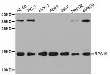 RPS19 / Ribosomal Protein S19 Antibody - Western blot analysis of extracts of various cell lines.
