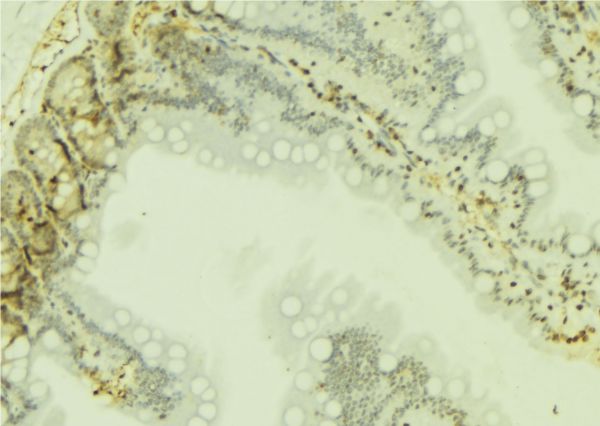RPS19 / Ribosomal Protein S19 Antibody - 1:100 staining mouse colon tissue by IHC-P. The sample was formaldehyde fixed and a heat mediated antigen retrieval step in citrate buffer was performed. The sample was then blocked and incubated with the antibody for 1.5 hours at 22°C. An HRP conjugated goat anti-rabbit antibody was used as the secondary.