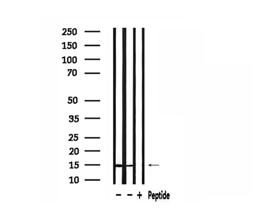 RPS19 / Ribosomal Protein S19 Antibody - Western blot analysis of extracts of HepG2 and 293 cells using RPS19 antibody.