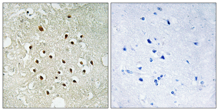 RPS19BP1 Antibody - Immunohistochemistry analysis of paraffin-embedded human brain tissue, using RPS19BP1 Antibody. The picture on the right is blocked with the synthesized peptide.