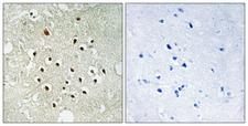 RPS19BP1 Antibody - Immunohistochemistry analysis of paraffin-embedded human brain tissue, using RPS19BP1 Antibody. The picture on the right is blocked with the synthesized peptide.