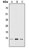 RPS19BP1 Antibody - Western blot analysis of RPS19BP1 expression in HEK293T (A); Raw264.7 (B); H9C2 (C) whole cell lysates.