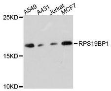 RPS19BP1 Antibody - Western blot analysis of extracts of various cell lines, using RPS19BP1 antibody at 1:3000 dilution. The secondary antibody used was an HRP Goat Anti-Rabbit IgG (H+L) at 1:10000 dilution. Lysates were loaded 25ug per lane and 3% nonfat dry milk in TBST was used for blocking. An ECL Kit was used for detection and the exposure time was 30s.