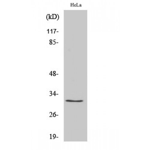 RPS2 / Ribosomal Protein S2 Antibody - Western blot of Ribosomal Protein S2 antibody