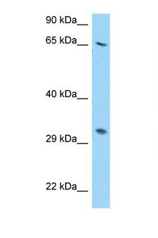 RPS2 / Ribosomal Protein S2 Antibody - RPS2 antibody Western blot of HepG2 Cell lysate. Antibody concentration 1 ug/ml.  This image was taken for the unconjugated form of this product. Other forms have not been tested.