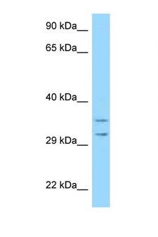 RPS2 / Ribosomal Protein S2 Antibody - RPS2 antibody Western blot of HeLa Cell lysate. Antibody concentration 1 ug/ml.  This image was taken for the unconjugated form of this product. Other forms have not been tested.