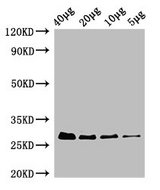 RPS2 / Ribosomal Protein S2 Antibody - Western Blot Positive WB detected in: Rosseta bacteria lysate at 40µg, 20µg, 10µg, 5µg All lanes: rpsB antibody at 0.42µg/ml Secondary Goat polyclonal to rabbit IgG at 1/50000 dilution Predicted band size: 27 kDa Observed band size: 27 kDa