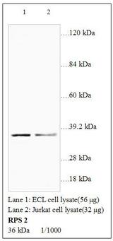 RPS2 / Ribosomal Protein S2 Antibody