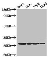 RPS2 / Ribosomal Protein S2 Antibody - Western Blot Positive WB detected in: Rosseta bacteria lysate at 80µg, 40µg, 20µg, 10µg All lanes: rpsB antibody at 2.5µg/ml Secondary Goat polyclonal to rabbit IgG at 1/50000 dilution predicted band size: 27 kDa observed band size: 27 kDa