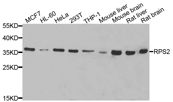 RPS2 / Ribosomal Protein S2 Antibody - Western blot analysis of extracts of various cell lines.