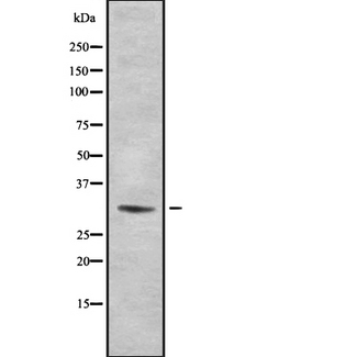 RPS2 / Ribosomal Protein S2 Antibody - Western blot analysis of Ribosomal Protein S2 using HeLa whole cells lysates