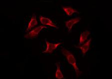 RPS2 / Ribosomal Protein S2 Antibody - Staining HeLa cells by IF/ICC. The samples were fixed with PFA and permeabilized in 0.1% Triton X-100, then blocked in 10% serum for 45 min at 25°C. The primary antibody was diluted at 1:200 and incubated with the sample for 1 hour at 37°C. An Alexa Fluor 594 conjugated goat anti-rabbit IgG (H+L) Ab, diluted at 1/600, was used as the secondary antibody.