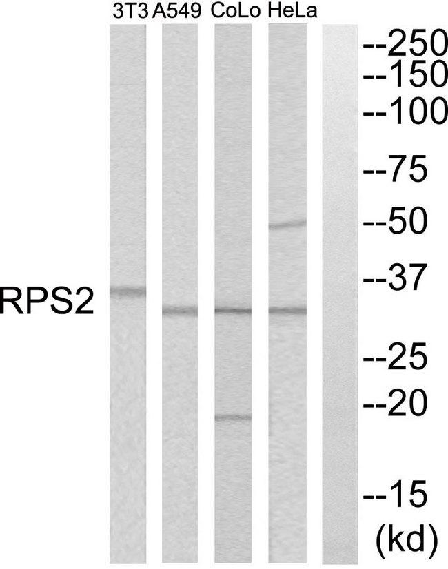 RPS2 / Ribosomal Protein S2 Antibody - Western blot analysis of extracts from HeLa cells, A549 cells, COLO205 cells and NIH-3T3 cells, using RPS2 antibody.