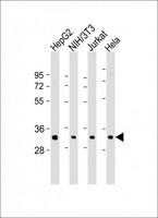 RPS2 / Ribosomal Protein S2 Antibody - All lanes: Anti-RPS2 Antibody (N-Term) at 1:2000 dilution Lane 1: HepG2 whole cell lysate Lane 2: NIH/3T3 whole cell lysate Lane 3: Jurkat whole cell lysate Lane 4: Hela whole cell lysate Lysates/proteins at 20 µg per lane. Secondary Goat Anti-Rabbit IgG, (H+L), Peroxidase conjugated at 1/10000 dilution. Predicted band size: 31 kDa Blocking/Dilution buffer: 5% NFDM/TBST.