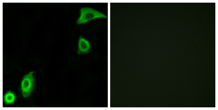 RPS20 / Ribosomal Protein S20 Antibody - Immunofluorescence analysis of A549 cells, using RPS20 Antibody. The picture on the right is blocked with the synthesized peptide.