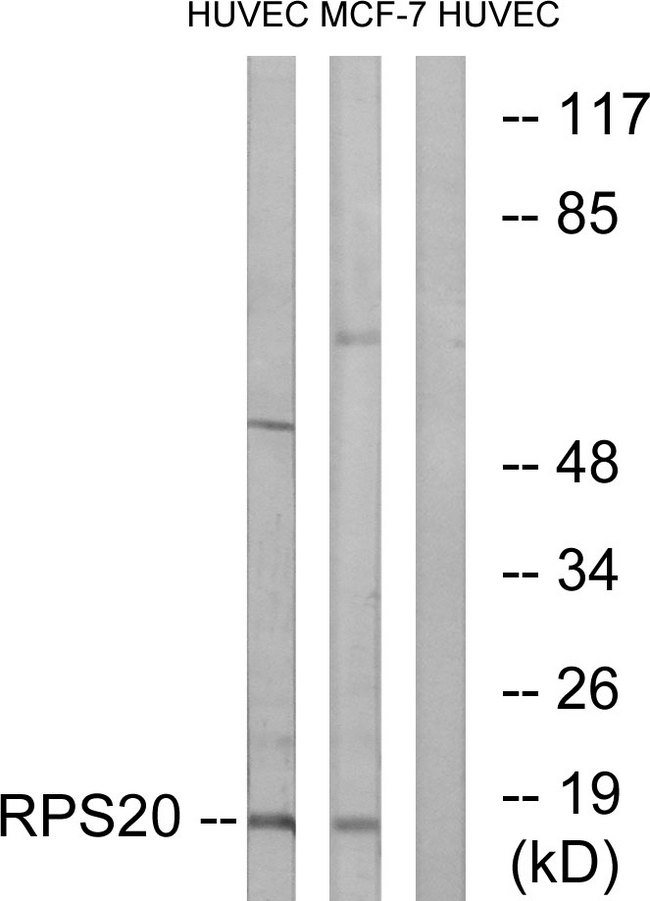 RPS20 / Ribosomal Protein S20 Antibody - Western blot analysis of lysates from HUVEC and MCF-7 cells, using RPS20 Antibody. The lane on the right is blocked with the synthesized peptide.