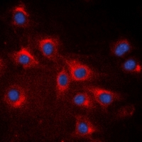 RPS20 / Ribosomal Protein S20 Antibody - Immunofluorescent analysis of RPS20 staining in A549 cells. Formalin-fixed cells were permeabilized with 0.1% Triton X-100 in TBS for 5-10 minutes and blocked with 3% BSA-PBS for 30 minutes at room temperature. Cells were probed with the primary antibody in 3% BSA-PBS and incubated overnight at 4 deg C in a humidified chamber. Cells were washed with PBST and incubated with a DyLight 594-conjugated secondary antibody (red) in PBS at room temperature in the dark. DAPI was used to stain the cell nuclei (blue).