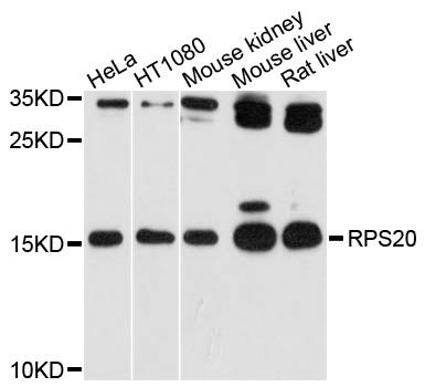 RPS20 / Ribosomal Protein S20 Antibody - Western blot analysis of extracts of various cell lines, using RPS20 antibody at 1:1000 dilution. The secondary antibody used was an HRP Goat Anti-Rabbit IgG (H+L) at 1:10000 dilution. Lysates were loaded 25ug per lane and 3% nonfat dry milk in TBST was used for blocking. An ECL Kit was used for detection and the exposure time was 60s.