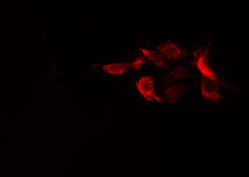 RPS20 / Ribosomal Protein S20 Antibody - Staining HuvEc cells by IF/ICC. The samples were fixed with PFA and permeabilized in 0.1% Triton X-100, then blocked in 10% serum for 45 min at 25°C. The primary antibody was diluted at 1:200 and incubated with the sample for 1 hour at 37°C. An Alexa Fluor 594 conjugated goat anti-rabbit IgG (H+L) antibody, diluted at 1/600, was used as secondary antibody.