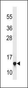 RPS23 / Ribosomal Protein S23 Antibody - RPS23 Antibody western blot of Jurkat cell line lysates (35 ug/lane). The RPS23 antibody detected the RPS23 protein (arrow).