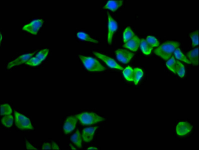 RPS23 / Ribosomal Protein S23 Antibody - Immunofluorescence staining of Hela cells diluted at 1:100, counter-stained with DAPI. The cells were fixed in 4% formaldehyde, permeabilized using 0.2% Triton X-100 and blocked in 10% normal Goat Serum. The cells were then incubated with the antibody overnight at 4°C.The Secondary antibody was Alexa Fluor 488-congugated AffiniPure Goat Anti-Rabbit IgG (H+L).