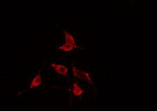 RPS23 / Ribosomal Protein S23 Antibody - Staining HeLa cells by IF/ICC. The samples were fixed with PFA and permeabilized in 0.1% Triton X-100, then blocked in 10% serum for 45 min at 25°C. The primary antibody was diluted at 1:200 and incubated with the sample for 1 hour at 37°C. An Alexa Fluor 594 conjugated goat anti-rabbit IgG (H+L) antibody, diluted at 1/600, was used as secondary antibody.