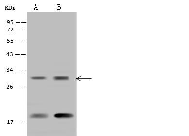 RPS23 / Ribosomal Protein S23 Antibody - Anti-RPS23 rabbit polyclonal antibody at 1:500 dilution. Lane A: HEK-293 Whole Cell Lysate. Lane B: U-251 MG Whole Cell Lysate. Lysates/proteins at 30 ug per lane. Secondary: Goat Anti-Rabbit IgG (H+L)/HRP at 1/10000 dilution. Developed using the ECL technique. Performed under reducing conditions. Predicted band size: 16 kDa. Observed band size: 18 kDa.