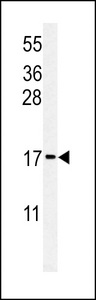 RPS24 / Ribosomal Protein S24 Antibody - Western blot of RPS24 Antibody in MCF-7 cell line lysates (35 ug/lane). RPS24 (arrow) was detected using the purified antibody.