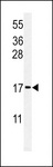 RPS24 / Ribosomal Protein S24 Antibody - Western blot of RPS24 Antibody in MCF-7 cell line lysates (35 ug/lane). RPS24 (arrow) was detected using the purified antibody.