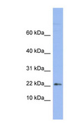 RPS24 / Ribosomal Protein S24 Antibody - RPS24 antibody Western blot of OVCAR-3 cell lysate. This image was taken for the unconjugated form of this product. Other forms have not been tested.