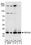 RPS24 / Ribosomal Protein S24 Antibody - Detection of Human RPS24 by Western Blot. Samples: Whole cell lysate from 293T (15 and 50 ug), HeLa (H; 50 ug), and Jurkat (J; 50 ug) cells. Antibodies: Affinity purified rabbit anti-RPS24 antibody used for WB at 0.1 ug/ml. Detection: Chemiluminescence with an exposure time of 10 seconds.