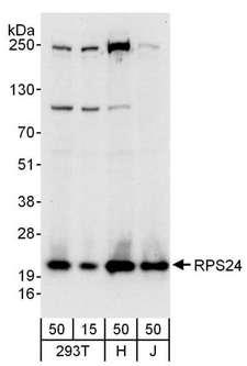 RPS24 / Ribosomal Protein S24 Antibody - Detection of Human RPS24 by Western Blot. Samples: Whole cell lysate from 293T (15 and 50 ug), HeLa (H; 50 ug), and Jurkat (J; 50 ug) cells. Antibodies: Affinity purified rabbit anti-RPS24 antibody used for WB at 0.1 ug/ml. Detection: Chemiluminescence with an exposure time of 10 seconds.