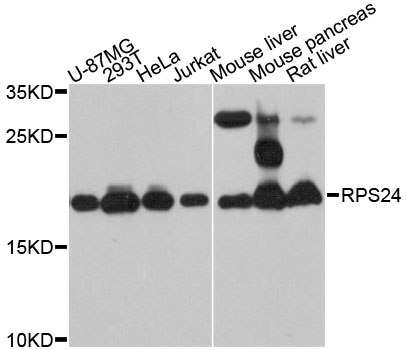 RPS24 / Ribosomal Protein S24 Antibody - Western blot analysis of extracts of various cell lines, using RPS24 antibody at 1:3000 dilution. The secondary antibody used was an HRP Goat Anti-Rabbit IgG (H+L) at 1:10000 dilution. Lysates were loaded 25ug per lane and 3% nonfat dry milk in TBST was used for blocking. An ECL Kit was used for detection and the exposure time was 30s.