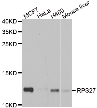 RPS27 / Ribosomal Protein S27 Antibody - Western blot analysis of extracts of various cell lines.